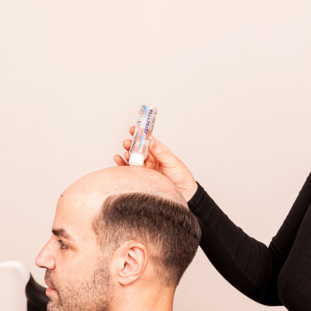 Walker Tape® Max Hold Sport – Scalp Protector Extra Forte per Massima Tenuta